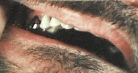 Gold Tooth