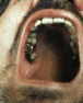 Gold Tooth